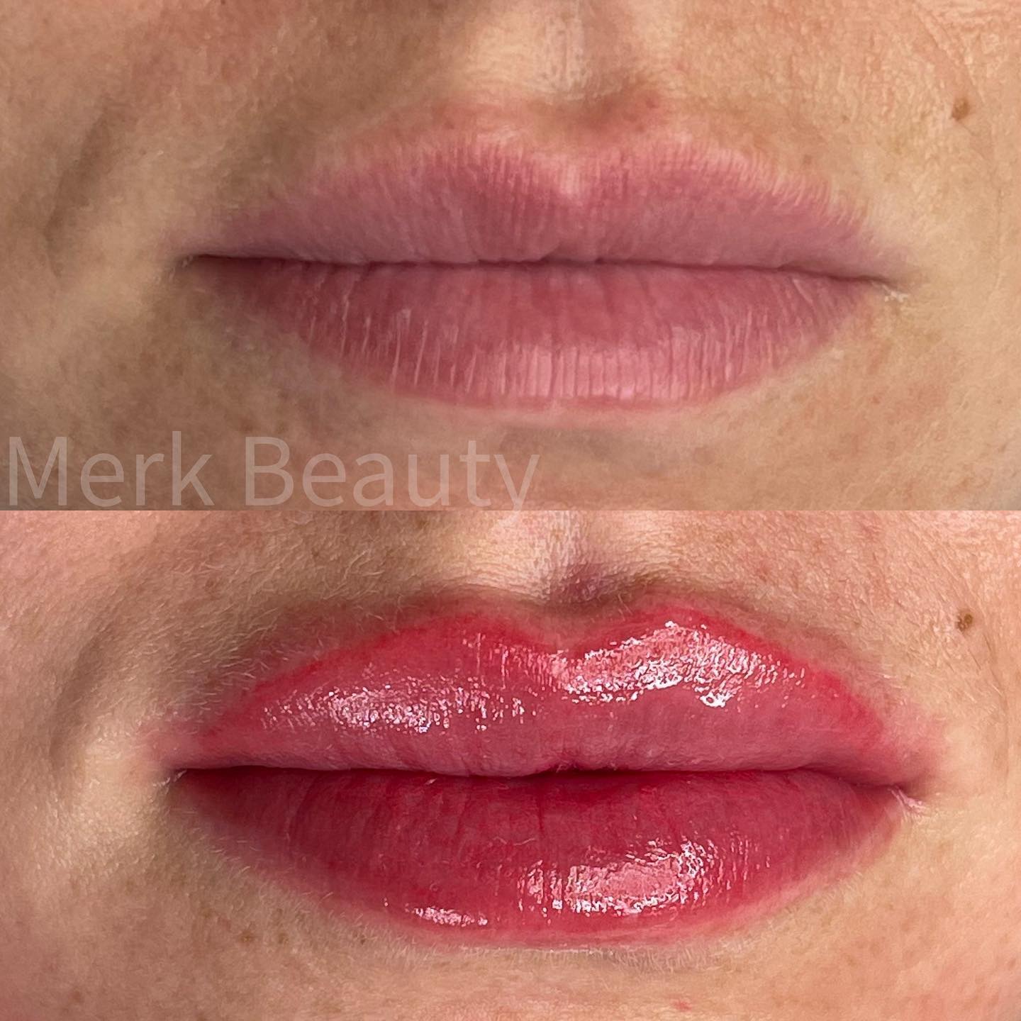 Full lip color treatment for vibrant, long-lasting lip pigmentation