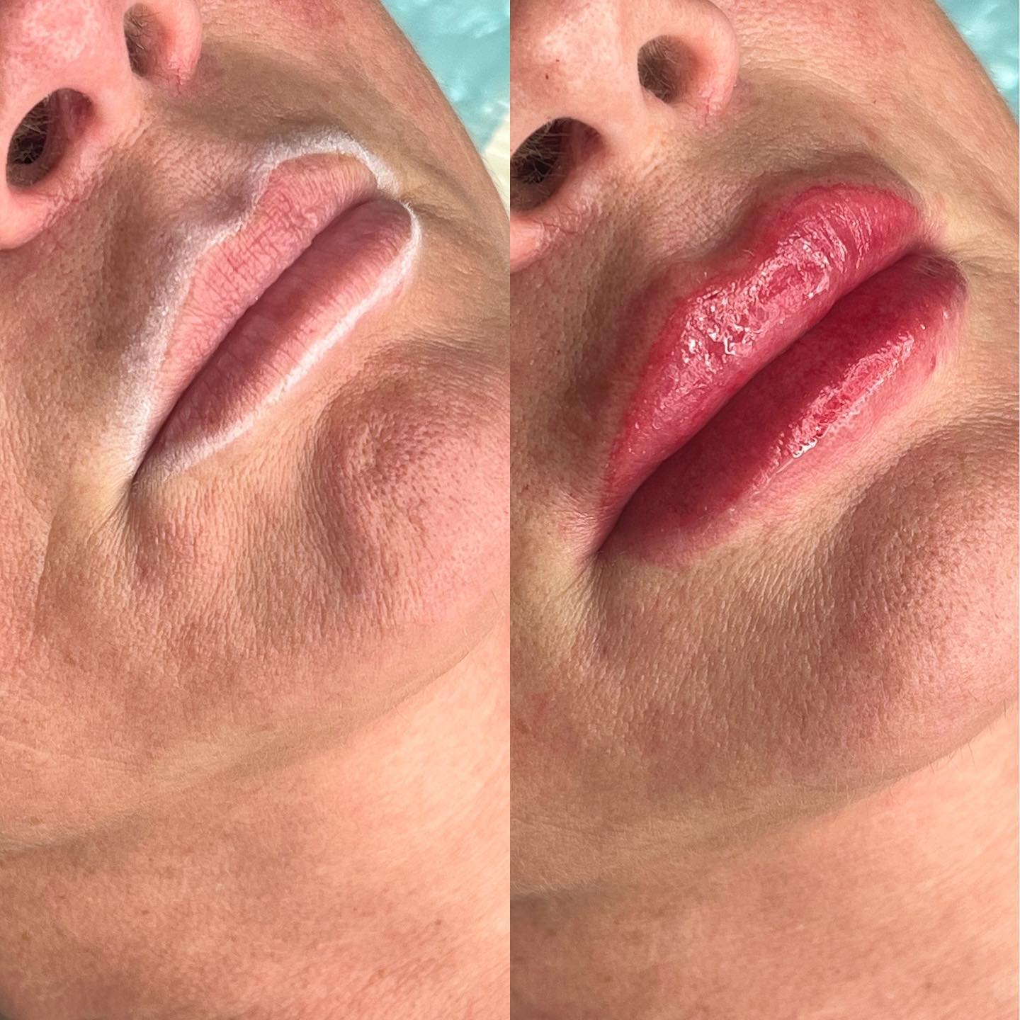 MERK Lip blushing service for naturally tinted, youthful-looking lips. LIPS Lip blushing service for naturally tinted, youthful-looking lips.