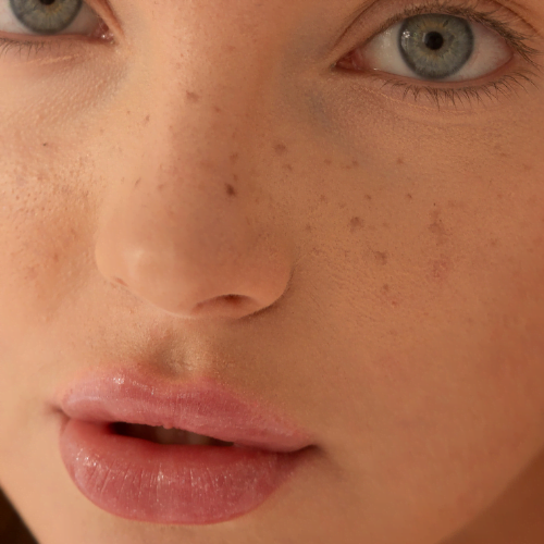 Discover the Art of Beauty Marks and Freckles: Adding Unique Flair to Your Look